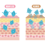 健康な肌と乾燥肌　図